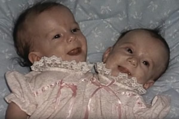 GodVine - Seeing conjoined twins Abby and Brittany now makes for one of  the best positive news stories out there! God created Abby and Brittany  Hensel so special. While these sisters share