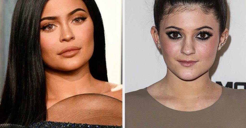 Tiktok Shows What Kylie Jenner Would Look Like Without Plastic Surgery 