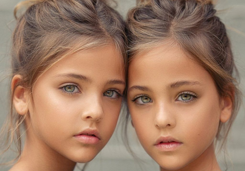 Remember The World's Most Beautiful Twins? Here's What They Look Like Today | Traitslab