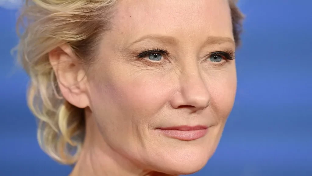 Autopsy Reveals Anne Heche's Real Cause Of Death | Traitslab